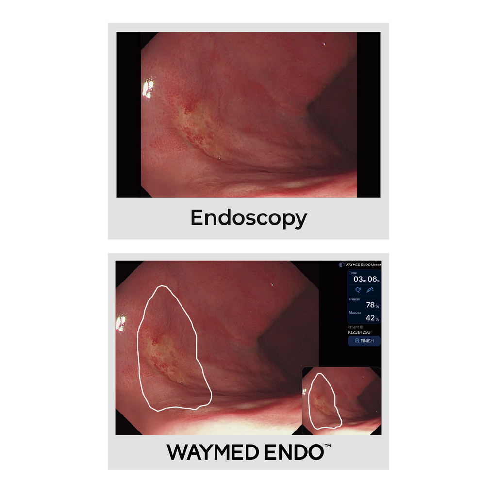 WAYMED Endo
