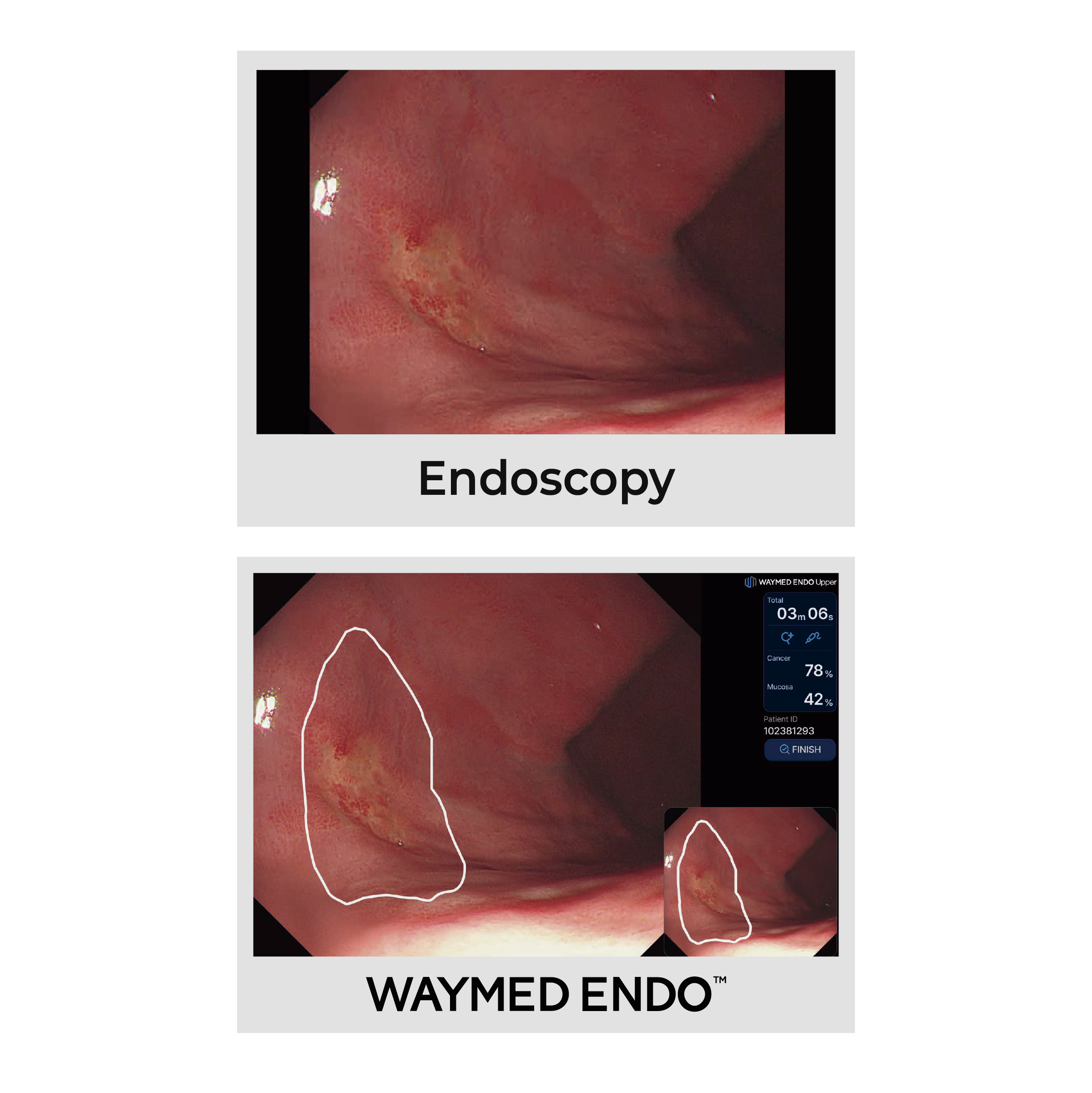 WAYMED Endo